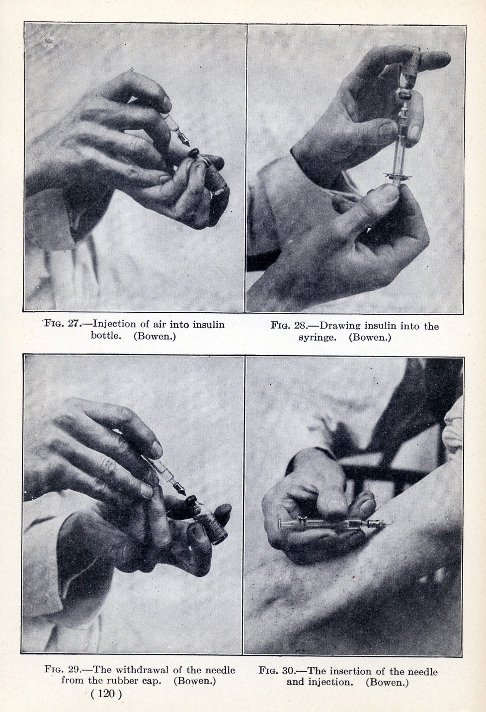Early diagram displaying how to properly inject someone with insulin